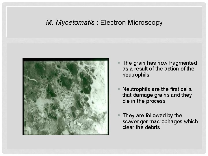 M. Mycetomatis : Electron Microscopy § The grain has now fragmented as a result