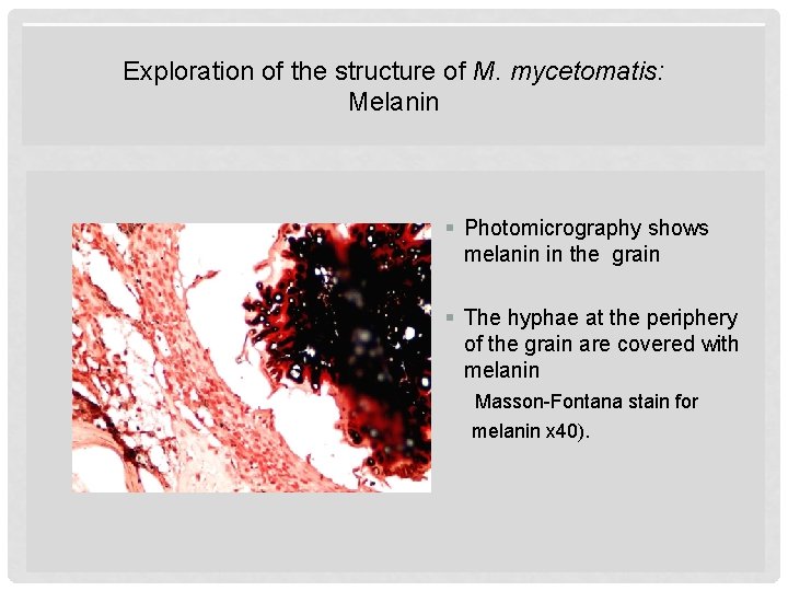 Exploration of the structure of M. mycetomatis: Melanin § Photomicrography shows melanin in the