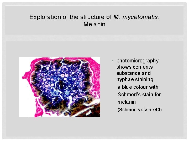 Exploration of the structure of M. mycetomatis: Melanin • photomicrography shows cements substance and