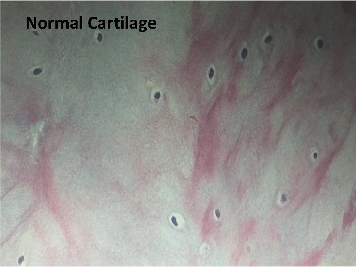 Normal Cartilage 