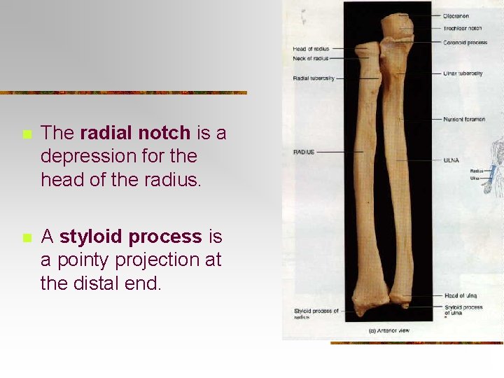 n The radial notch is a depression for the head of the radius. n