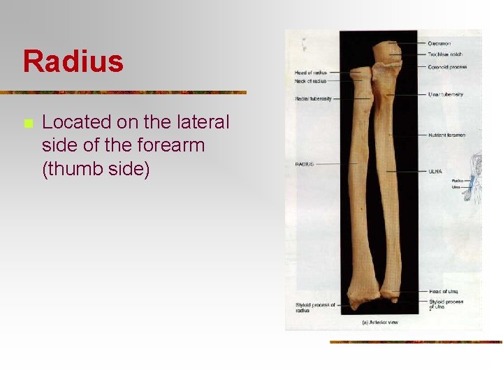 Radius n Located on the lateral side of the forearm (thumb side) 