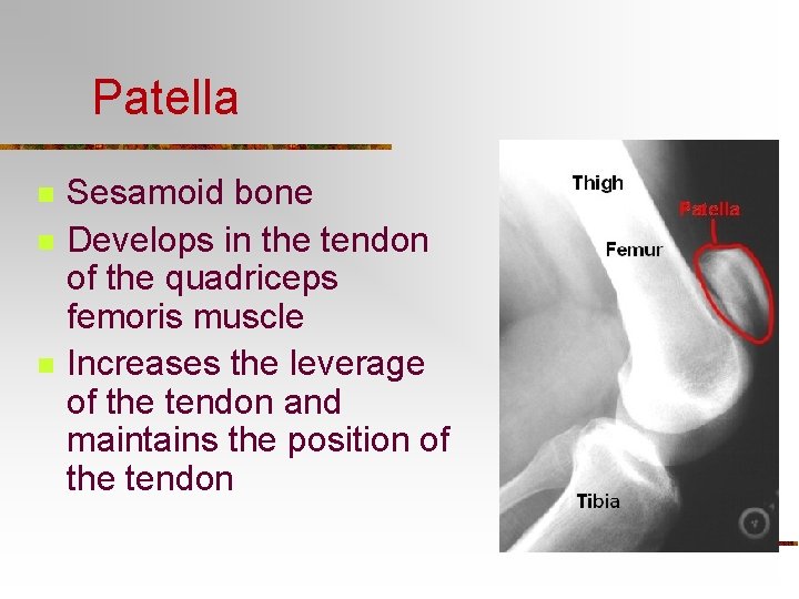 Patella n n n Sesamoid bone Develops in the tendon of the quadriceps femoris