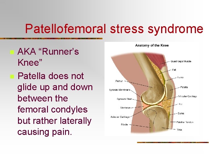 Patellofemoral stress syndrome n n AKA “Runner’s Knee” Patella does not glide up and