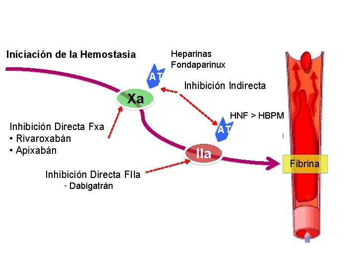 Heparinas Fondaparinux Iniciación de la Hemostasia AT Xa Inhibición Indirecta HNF > HBPM Inhibición