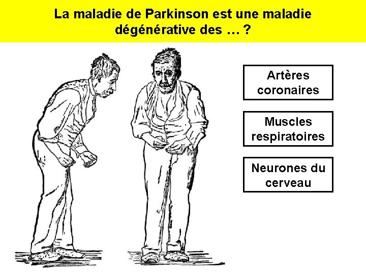 La maladie de Parkinson est une maladie dégénérative des … ? Artères coronaires Muscles