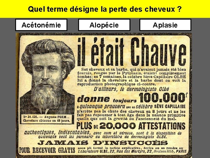 Quel terme désigne la perte des cheveux ? Acétonémie Alopécie Aplasie 