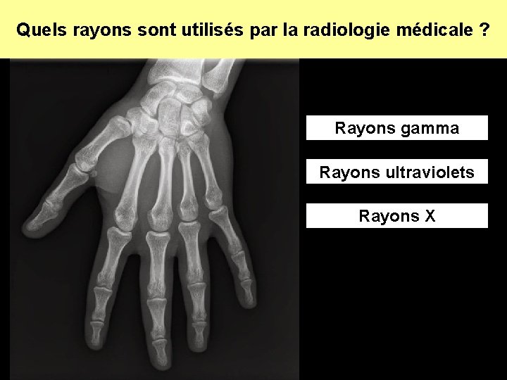 Quels rayons sont utilisés par la radiologie médicale ? Rayons gamma Rayons ultraviolets Rayons