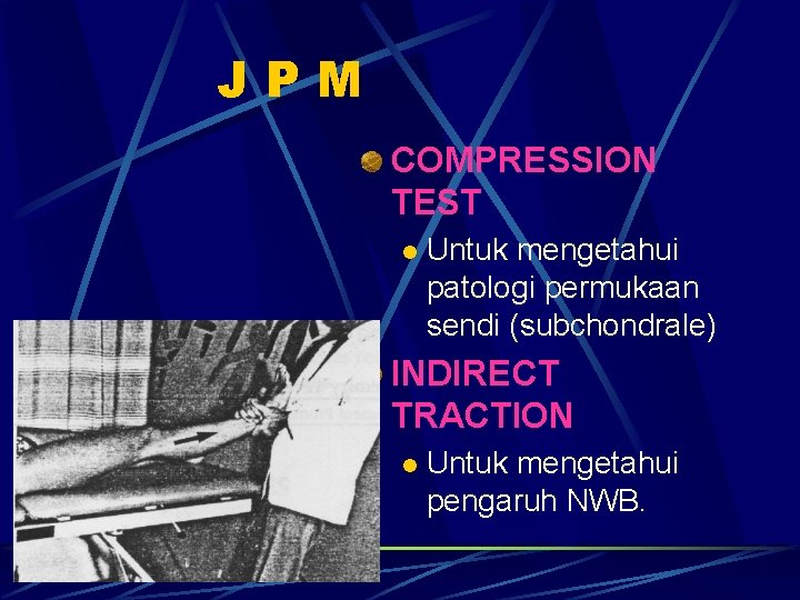 JPM COMPRESSION TEST l Untuk mengetahui patologi permukaan sendi (subchondrale) INDIRECT TRACTION l Untuk JPM COMPRESSION TEST l Untuk mengetahui patologi permukaan sendi (subchondrale) INDIRECT TRACTION l Untuk