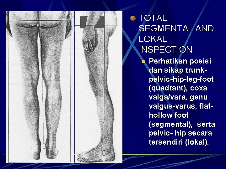 TOTAL, SEGMENTAL AND LOKAL INSPECTION l Perhatikan posisi dan sikap trunkpelvic-hip-leg-foot (quadrant), coxa valga/vara, TOTAL, SEGMENTAL AND LOKAL INSPECTION l Perhatikan posisi dan sikap trunkpelvic-hip-leg-foot (quadrant), coxa valga/vara,