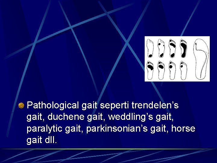Pathological gait seperti trendelen’s gait, duchene gait, weddling’s gait, paralytic gait, parkinsonian’s gait, horse Pathological gait seperti trendelen’s gait, duchene gait, weddling’s gait, paralytic gait, parkinsonian’s gait, horse