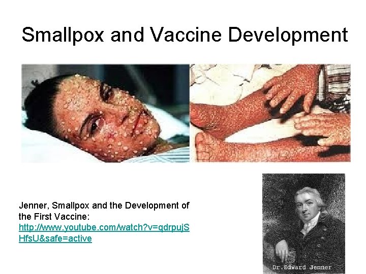 Smallpox and Vaccine Development Jenner, Smallpox and the Development of the First Vaccine: http: Smallpox and Vaccine Development Jenner, Smallpox and the Development of the First Vaccine: http: