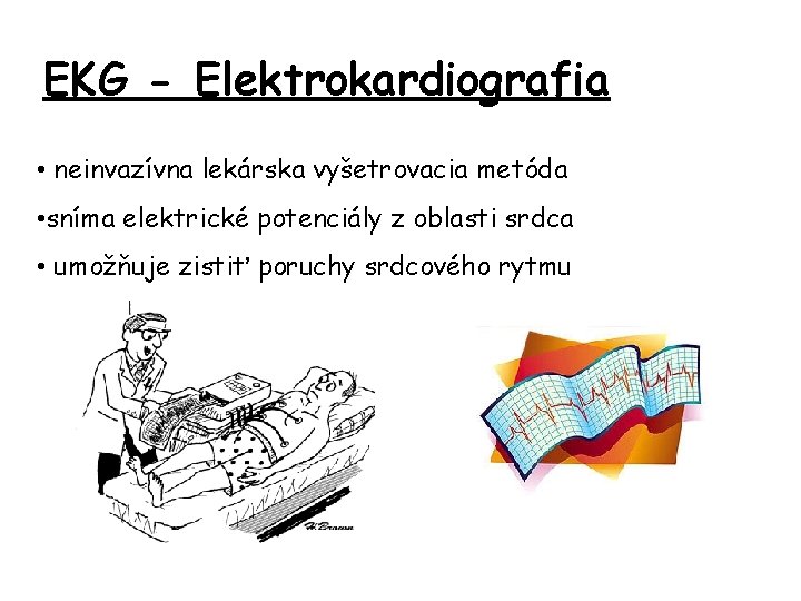 EKG - Elektrokardiografia • neinvazívna lekárska vyšetrovacia metóda • sníma elektrické potenciály z oblasti