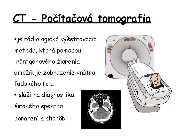 CT - Počítačová tomografia • je rádiologická vyšetrovacia metóda, ktorá pomocou röntgenového žiarenia umožňuje