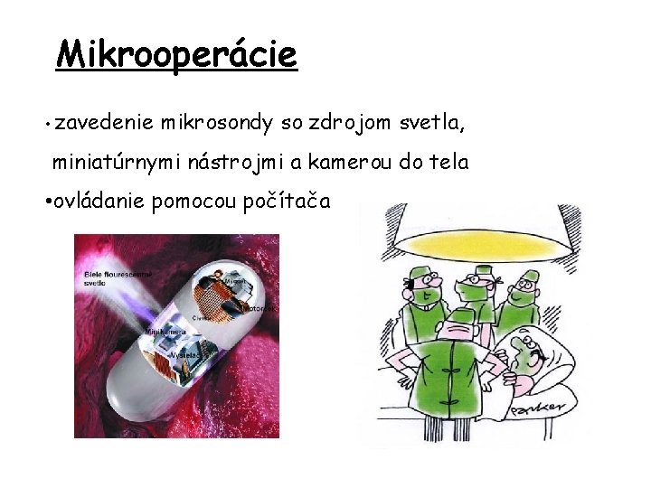 Mikrooperácie • zavedenie mikrosondy so zdrojom svetla, miniatúrnymi nástrojmi a kamerou do tela •