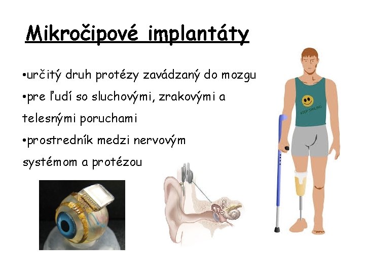 Mikročipové implantáty • určitý druh protézy zavádzaný do mozgu • pre ľudí so sluchovými,