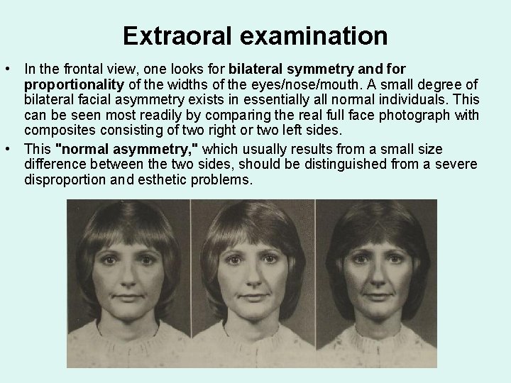 Extraoral examination • In the frontal view, one looks for bilateral symmetry and for