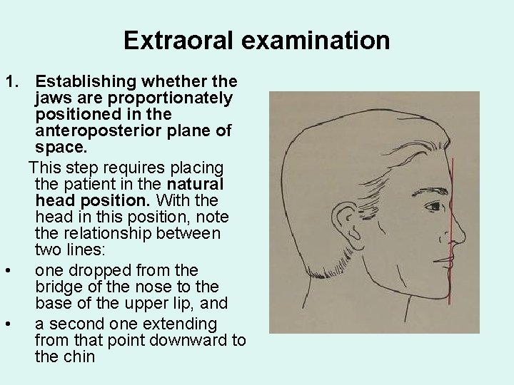 Extraoral examination 1. Establishing whether the jaws are proportionately positioned in the anteroposterior plane