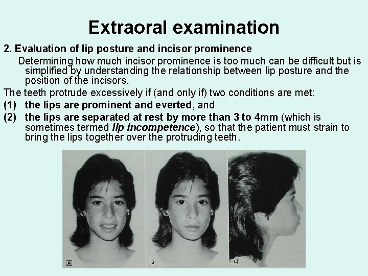 Extraoral examination 2. Evaluation of lip posture and incisor prominence Determining how much incisor