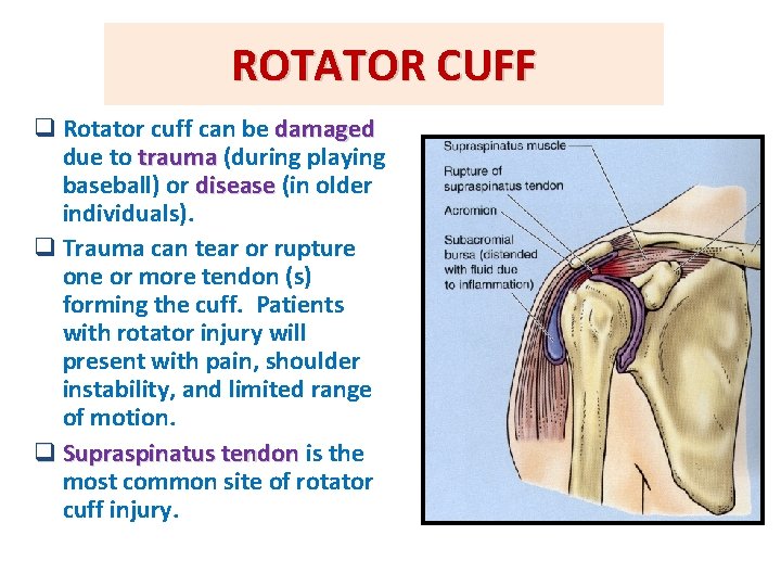 ROTATOR CUFF q Rotator cuff can be damaged due to trauma (during playing baseball) ROTATOR CUFF q Rotator cuff can be damaged due to trauma (during playing baseball)
