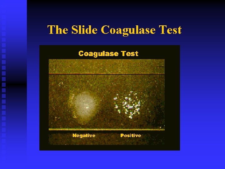 The Slide Coagulase Test 