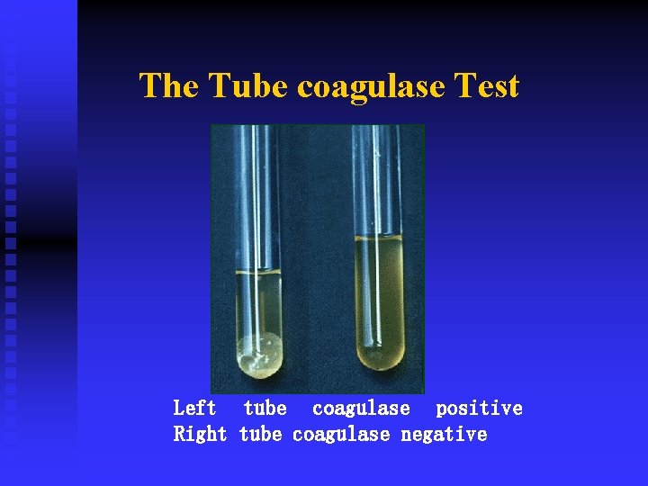 The Tube coagulase Test Left tube coagulase positive Right tube coagulase negative 