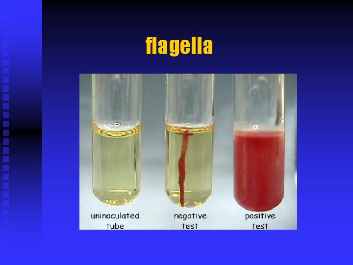 flagella 
