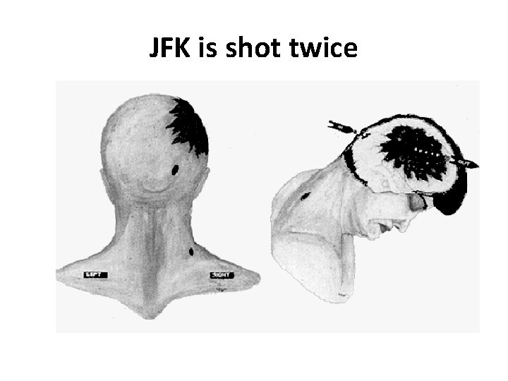 JFK is shot twice JFK is shot twice