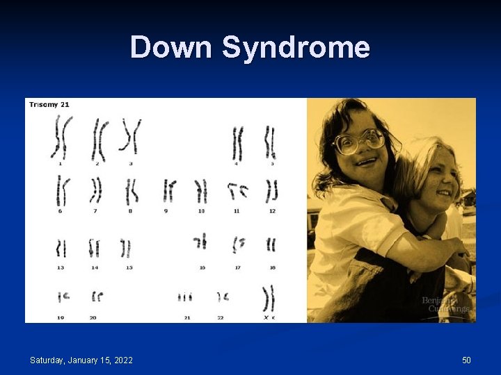 Down Syndrome Saturday, January 15, 2022 50 