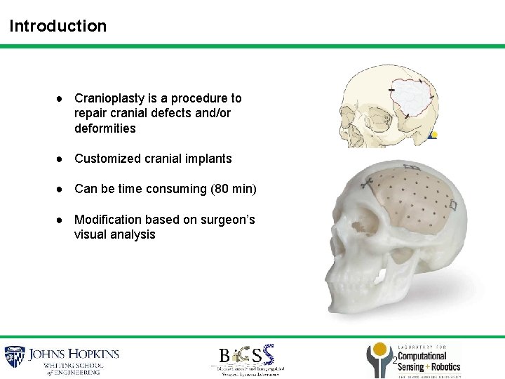 Introduction ● Cranioplasty is a procedure to repair cranial defects and/or deformities ● Customized