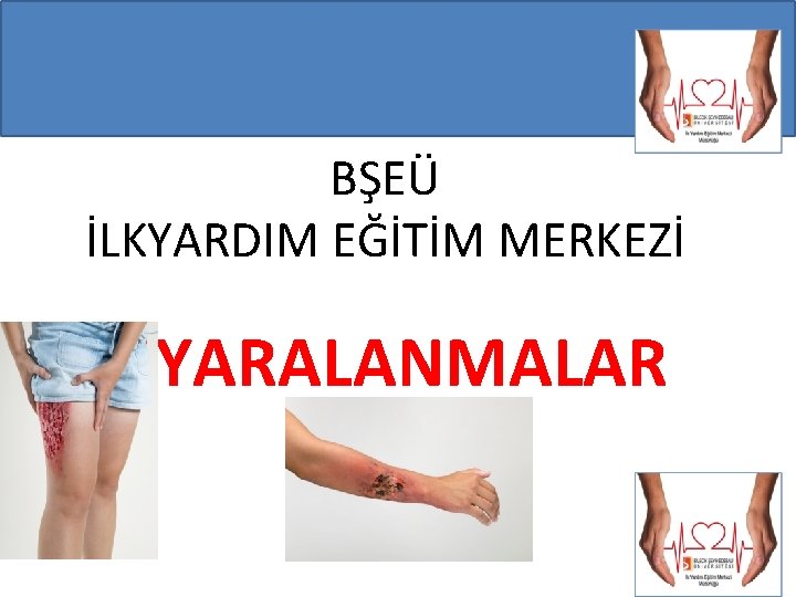 BŞEÜ İLKYARDIM EĞİTİM MERKEZİ YARALANMALAR 