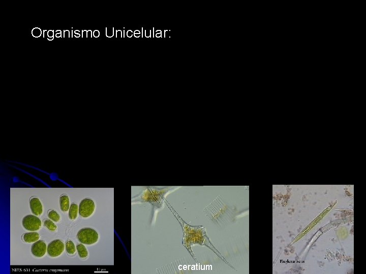 Organismo Unicelular: ceratium 
