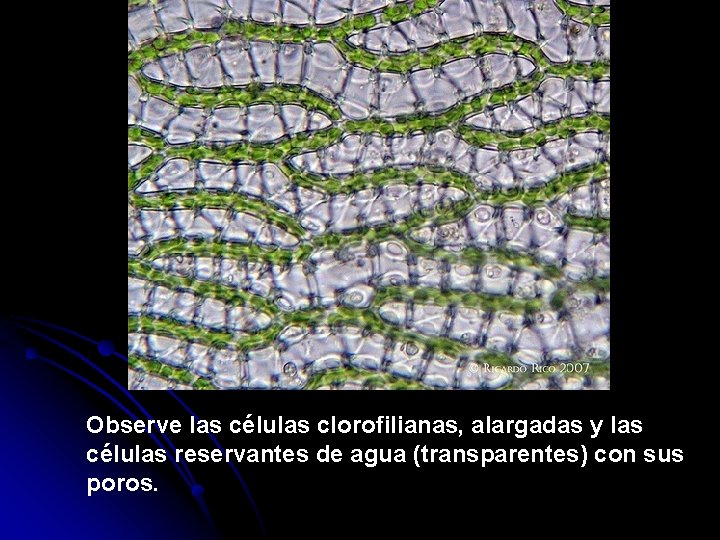 Observe las células clorofilianas, alargadas y las células reservantes de agua (transparentes) con sus