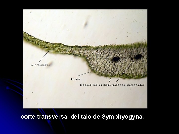 corte transversal del talo de Symphyogyna. 