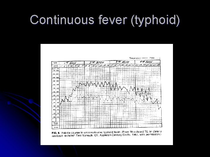 Continuous fever (typhoid) 