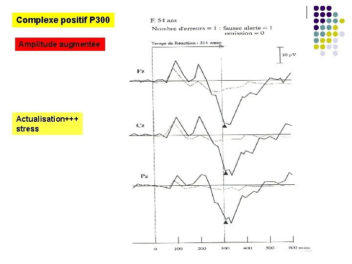 Complexe positif P 300 Amplitude augmentée Actualisation+++ stress 