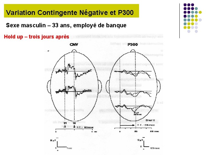 Variation Contingente Négative et P 300 Sexe masculin – 33 ans, employé de banque