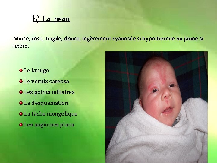 b) La peau Mince, rose, fragile, douce, légèrement cyanosée si hypothermie ou jaune si