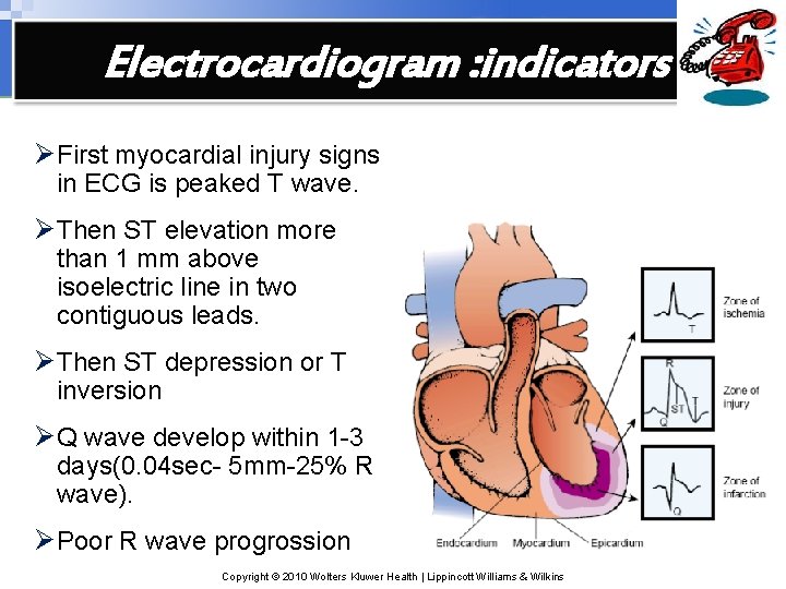 Electrocardiogram : indicators Ø First myocardial injury signs in ECG is peaked T wave.