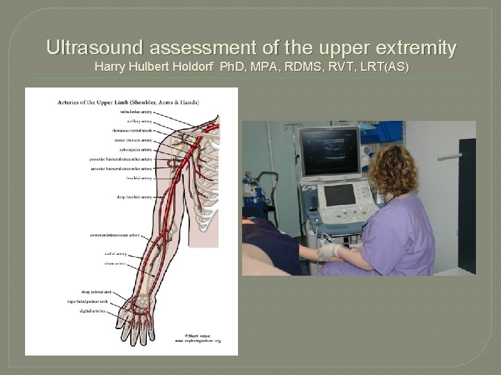 Ultrasound assessment of the upper extremity Harry Hulbert Holdorf Ph. D, MPA, RDMS, RVT,