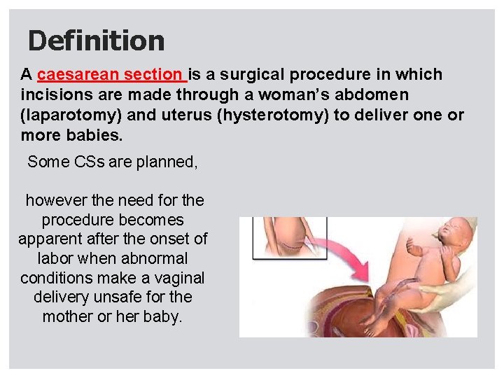 Cesarean section introduction zedan alsaleh Abdomin uterus incesion