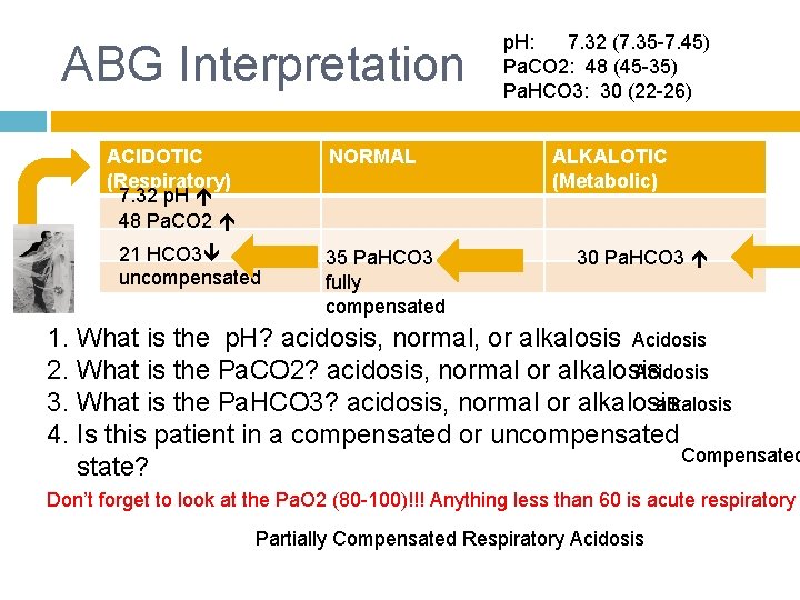 ABG Interpretation ACIDOTIC (Respiratory) 7. 32 p. H 48 Pa. CO 2 NORMAL 21