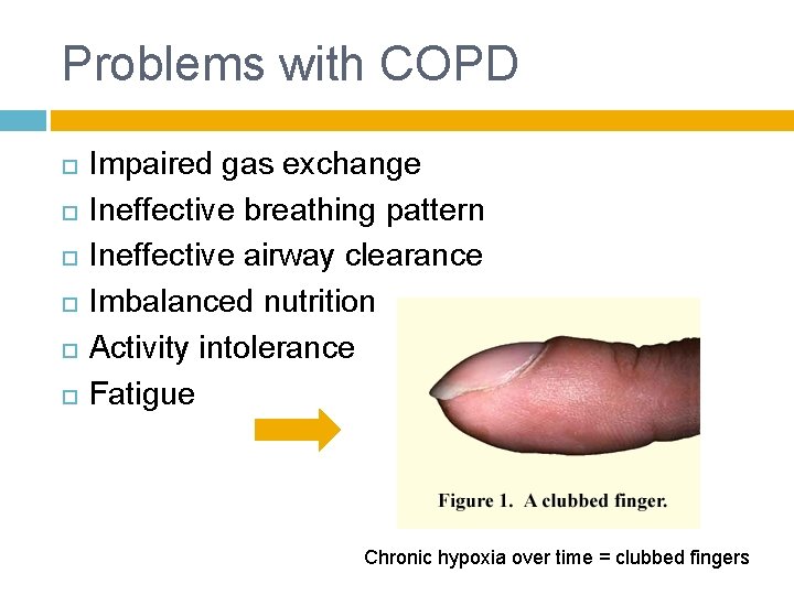 Problems with COPD Impaired gas exchange Ineffective breathing pattern Ineffective airway clearance Imbalanced nutrition