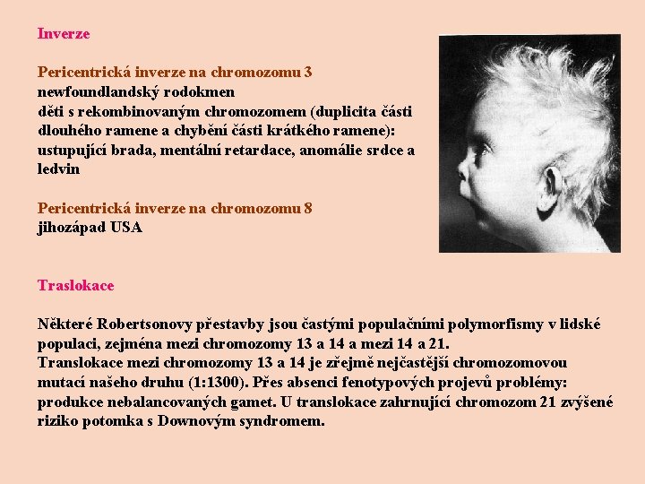 Inverze Pericentrická inverze na chromozomu 3 newfoundlandský rodokmen děti s rekombinovaným chromozomem (duplicita části