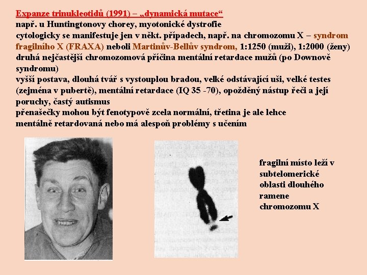 Expanze trinukleotidů (1991) – „dynamická mutace“ např. u Huntingtonovy chorey, myotonické dystrofie cytologicky se