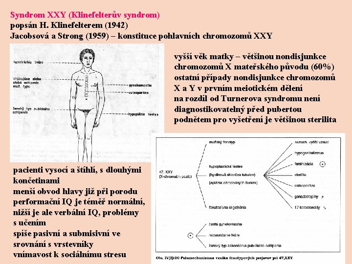 Syndrom XXY (Klinefelterův syndrom) popsán H. Klinefelterem (1942) Jacobsová a Strong (1959) – konstituce