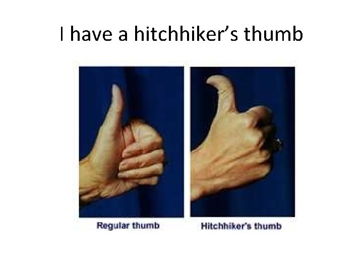 I have a hitchhiker’s thumb I have a hitchhiker’s thumb