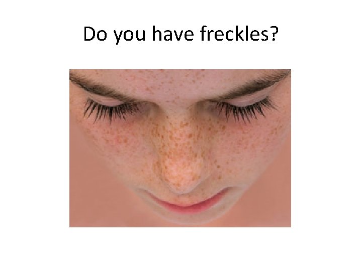 Do you have freckles? Do you have freckles?
