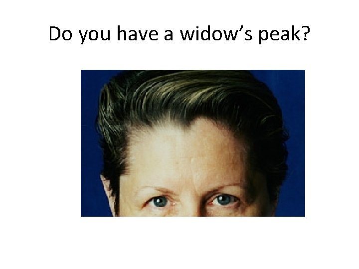 Do you have a widow’s peak? Do you have a widow’s peak?