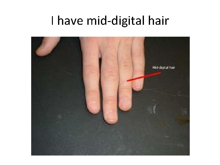 I have mid-digital hair I have mid-digital hair